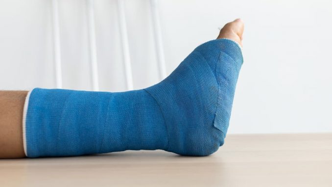Bein im Gipsverband - krankenkasse im ausland privatarzt